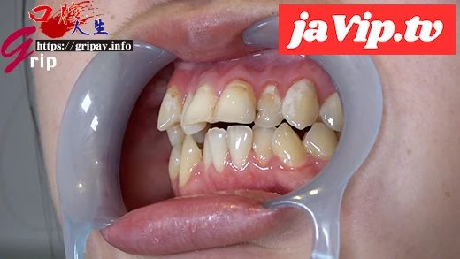 fc2ppv-4583588 - 明るい変態フェチっ*ささ歯並び特徴的な口腔内＆歯みがき開口器接写 - FC2PPV動画をオンラインで視聴 - jaVip