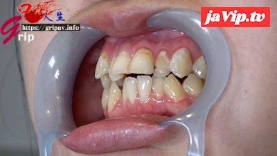 fc2ppv-4583588 - 明るい変態フェチっ*ささ歯並び特徴的な口腔内＆歯みがき開口器接写