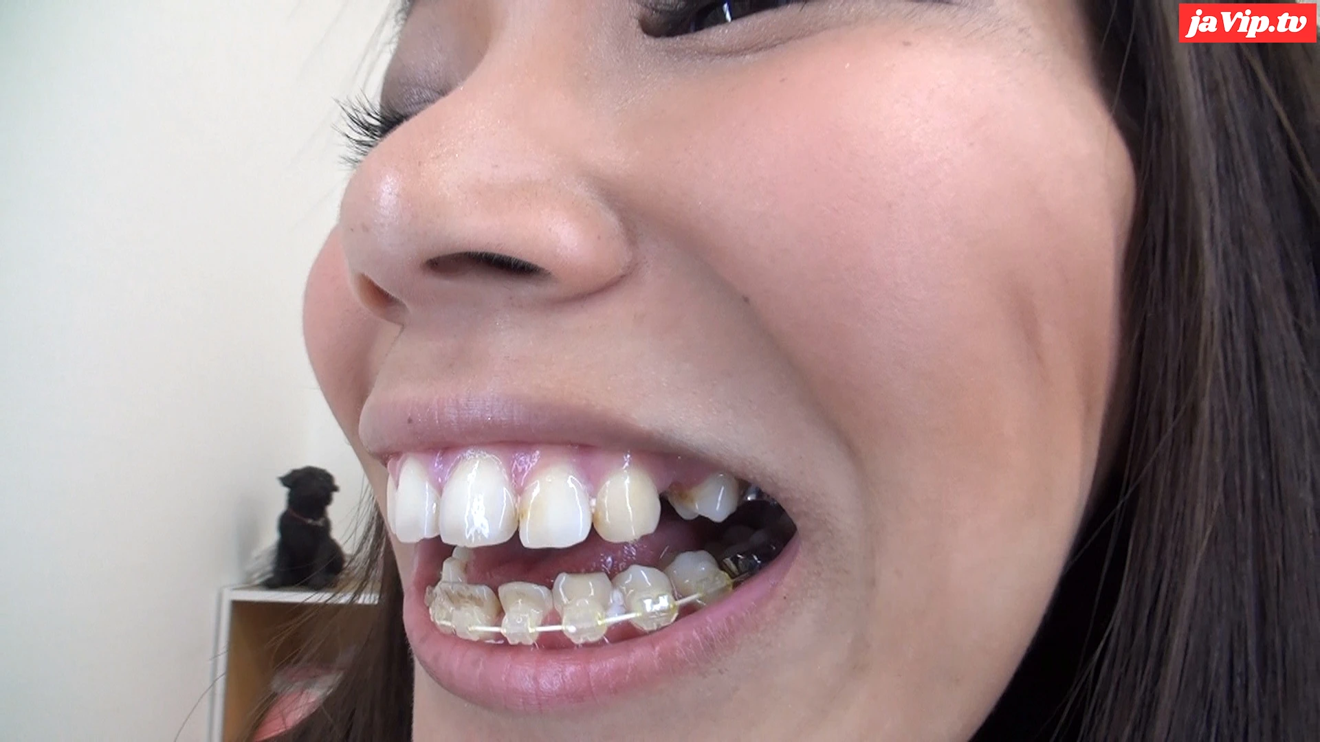 fc2ppv-4119644 - 安里泉水ちゃんの歯・口内自撮り 物凄い矯正歯 - FC2PPV動画をオンラインで視聴 - jaVip
