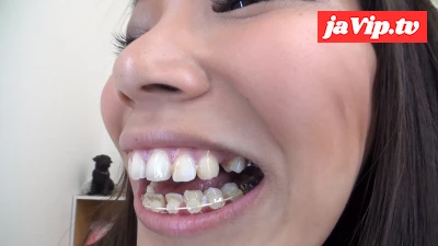 fc2ppv-4119644 - 安里泉水ちゃんの歯・口内自撮り 物凄い矯正歯