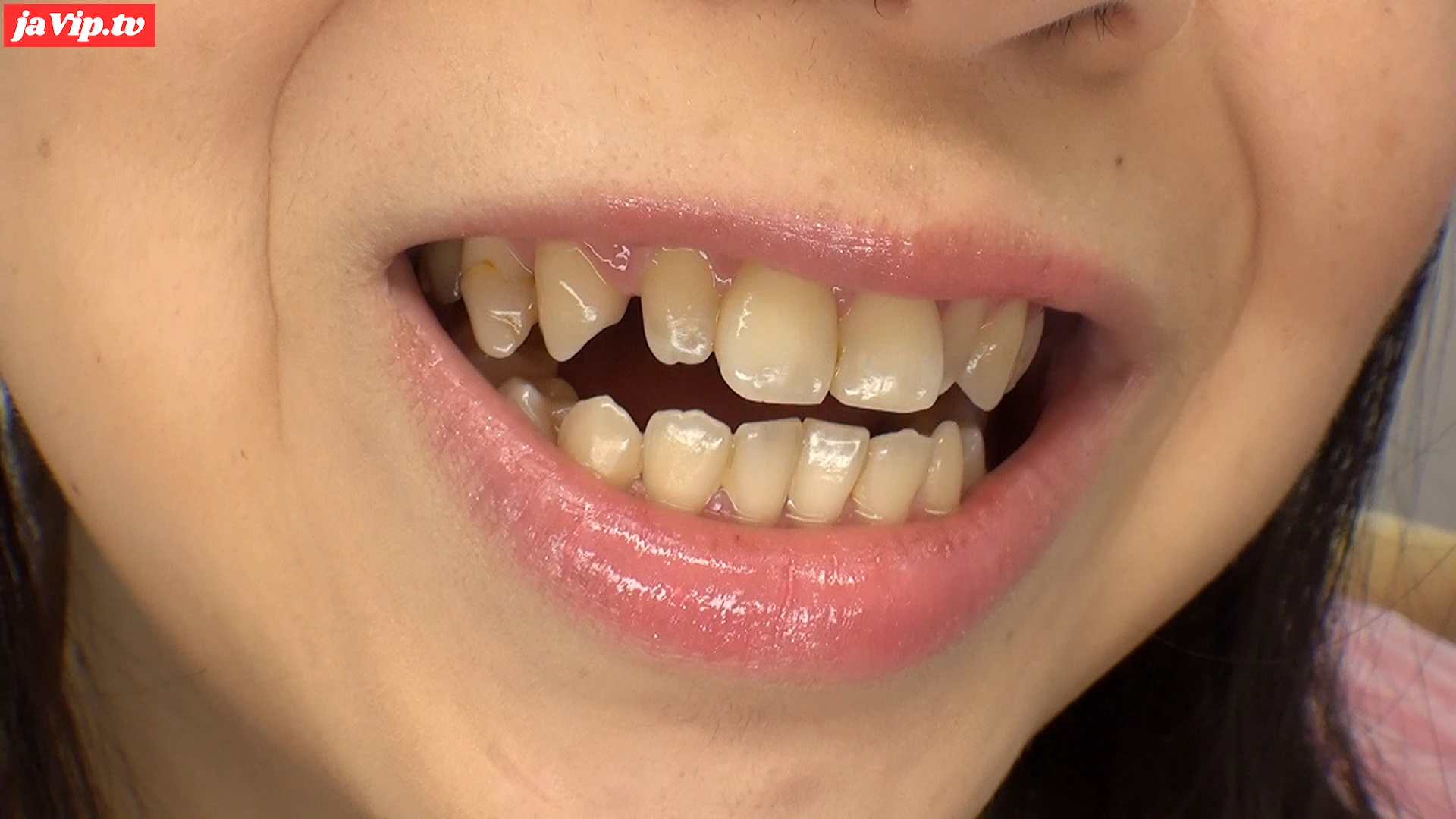 fc2ppv-4243072 - 涼宮凛ちゃんのクラウンを観察！ 詰め物取れてますよね？ - FC2PPV動画をオンラインで視聴 - jaVip