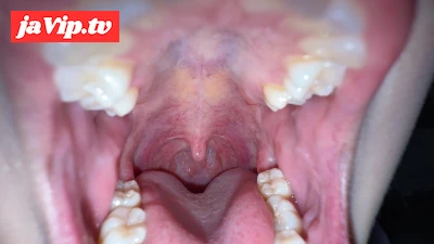 fc2ppv-4752113 - 【個人撮影】谷田かりな　開口器で口内観察デカ舌を要チェック